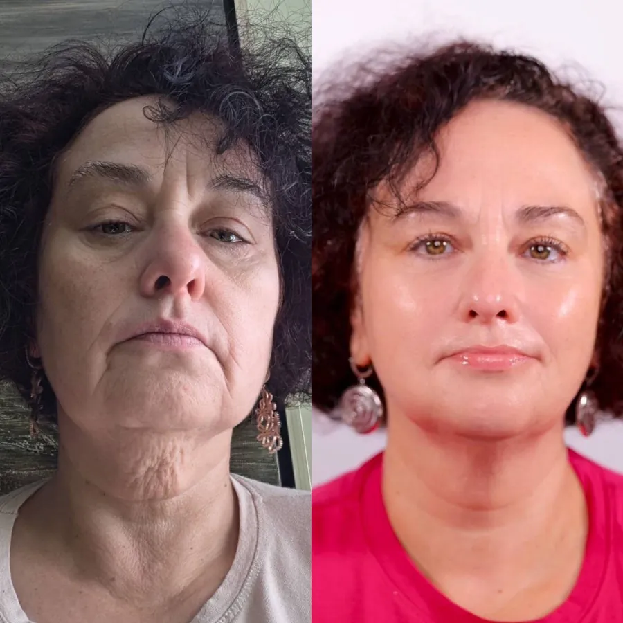Claudia Vietinghoff, 59, before and after using the Face Fitness method