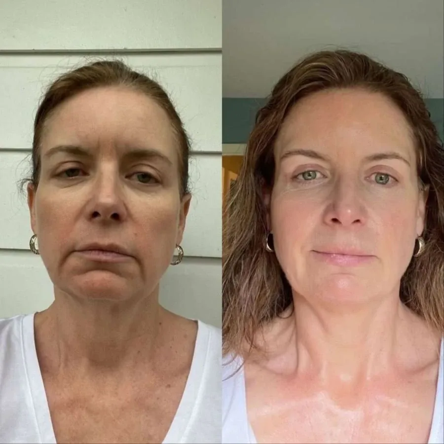 Matilda Hargreaves, before and after using the Face Fitness method