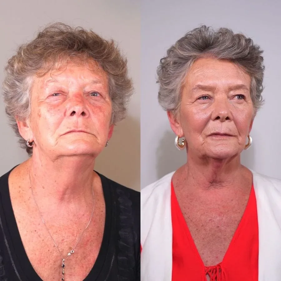 Sienna Walsh, before and after using the Face Fitness method