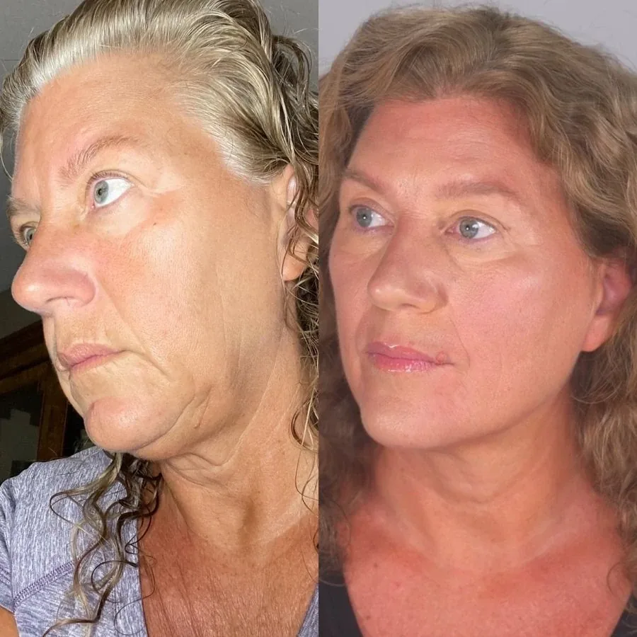 Kendra, before and after using the Face Fitness method